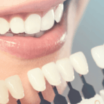 What to Know About Teeth Whitening -Intercare Health Hub