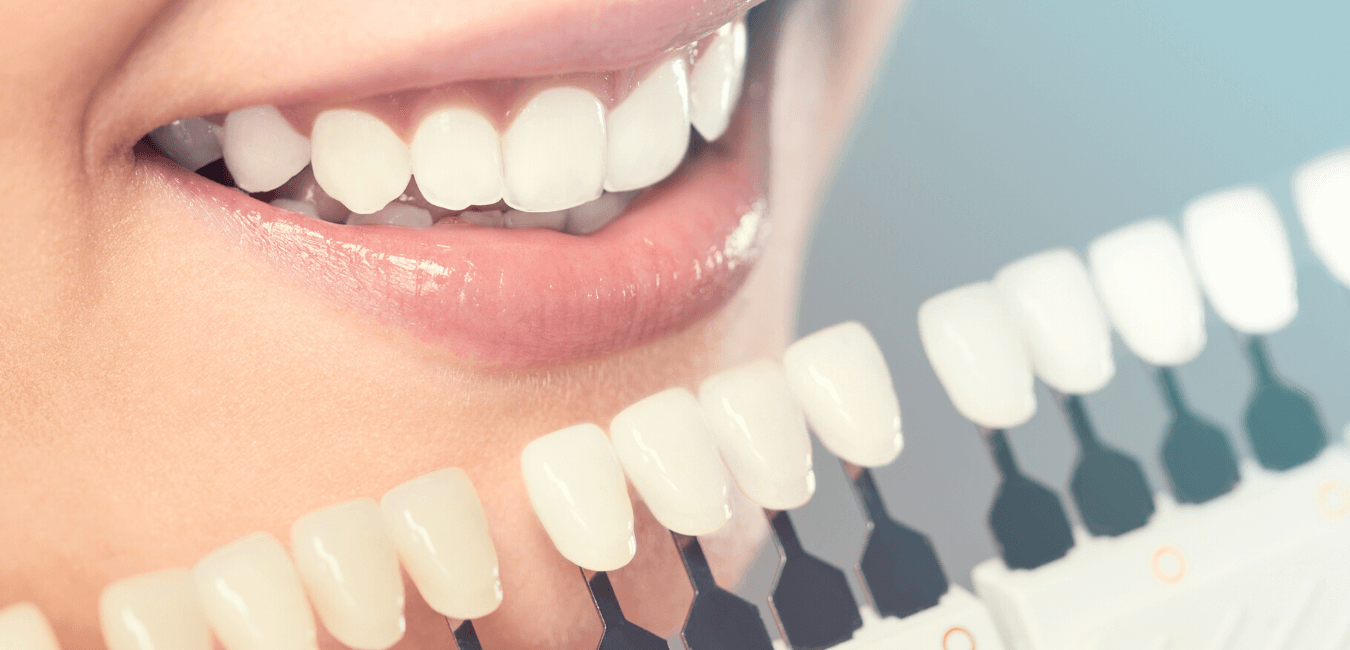 What to Know About Teeth Whitening -Intercare Health Hub