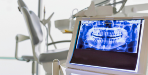 The crucial link between chronic diseases and dental health